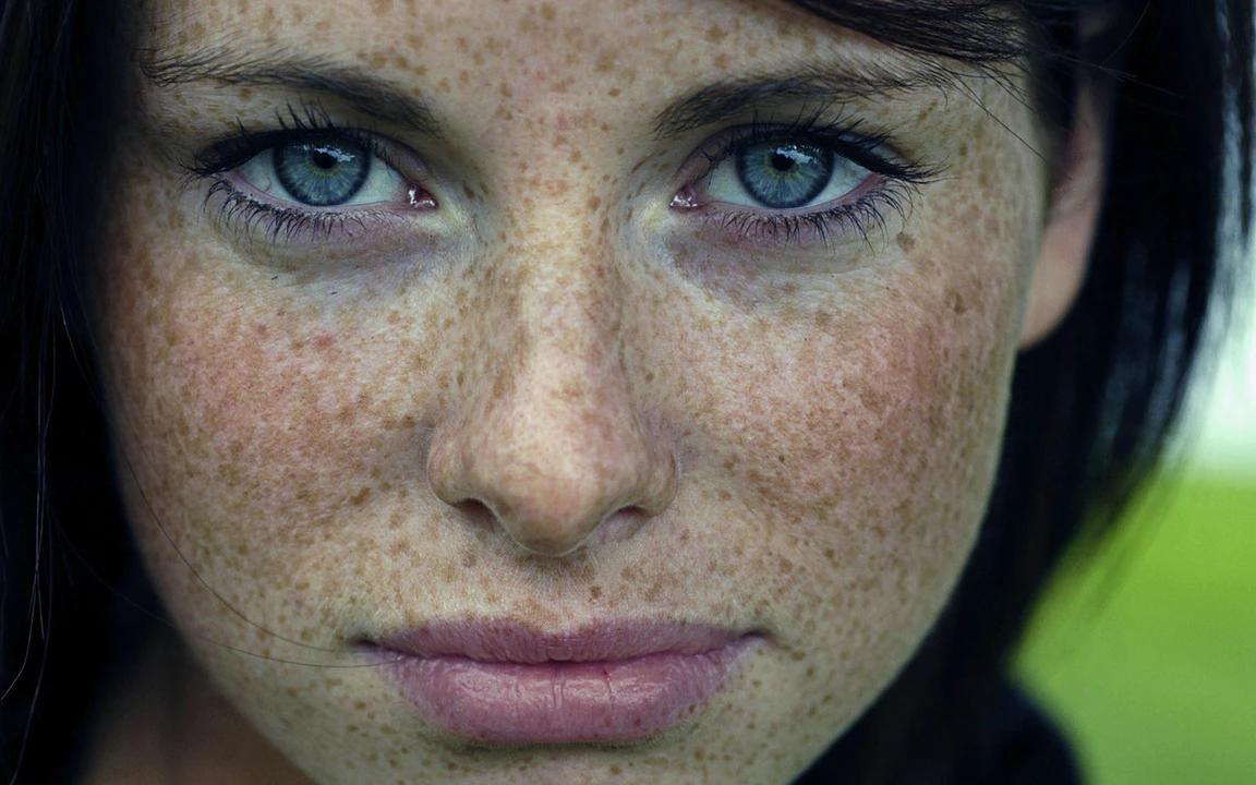 The different types of freckles and what they can reveal about your ancestry