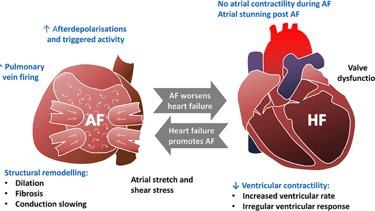 Atrial Fibrillation and Alternative Therapies: Are They Effective?